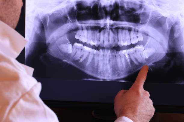 Best Chipped Tooth Repair Near Me  in Ocklawaha, FL